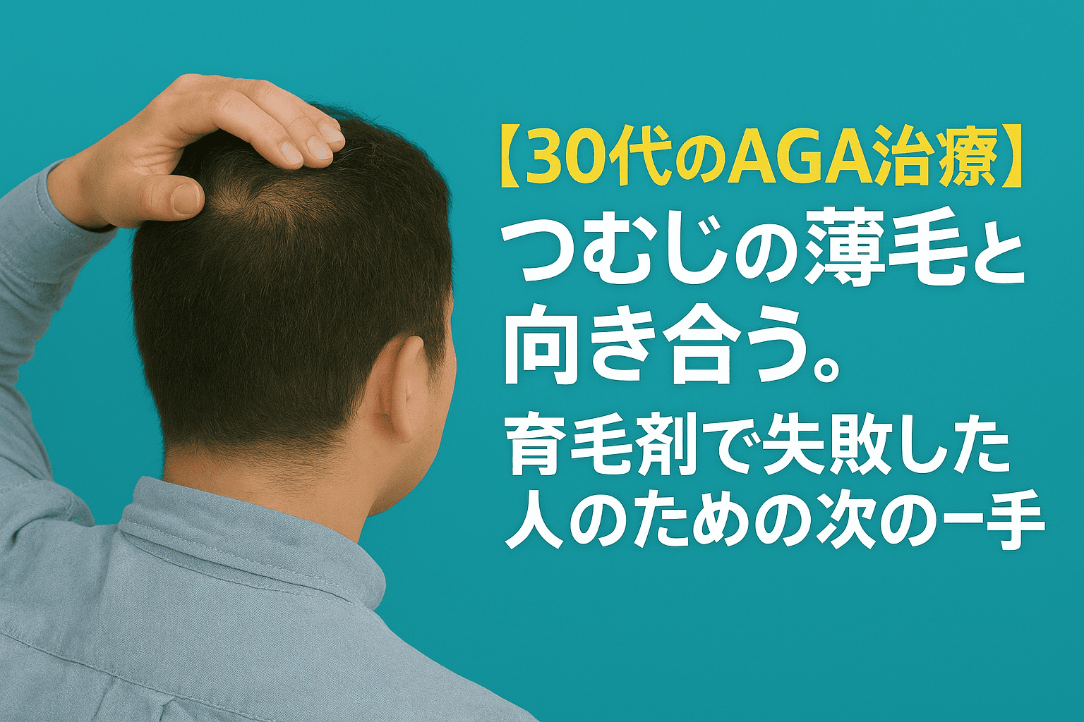 30代の薄毛と向き合う、育毛剤で失敗した人のための次の一手