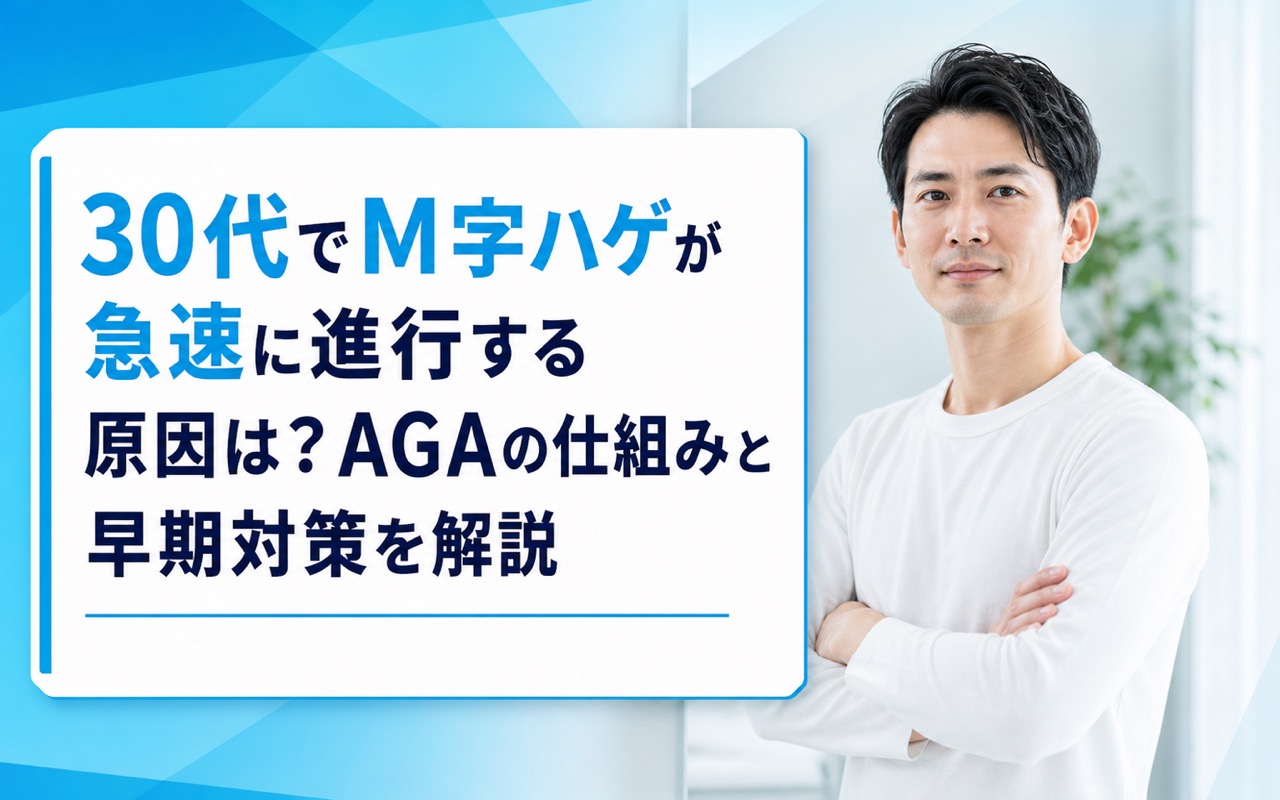 30代でM字ハゲが急速に進行する原因は？AGAの仕組みと早期対策を解説
